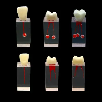 10 Adet Diş Diş Kök Kanal Modeli Endodontik Hamuru RCT Uygulama Çalışma Bloğu